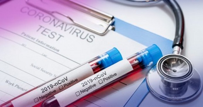 Salud tomará muestras a los profesionales de servicios esenciales para la detección del coronavirus sin que tengan que bajarse de sus vehículos - Asturias
